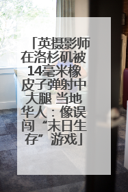 英摄影师在洛杉矶被14毫米橡皮子弹射中大腿 当地华人：像误闯“末日生存”游戏
